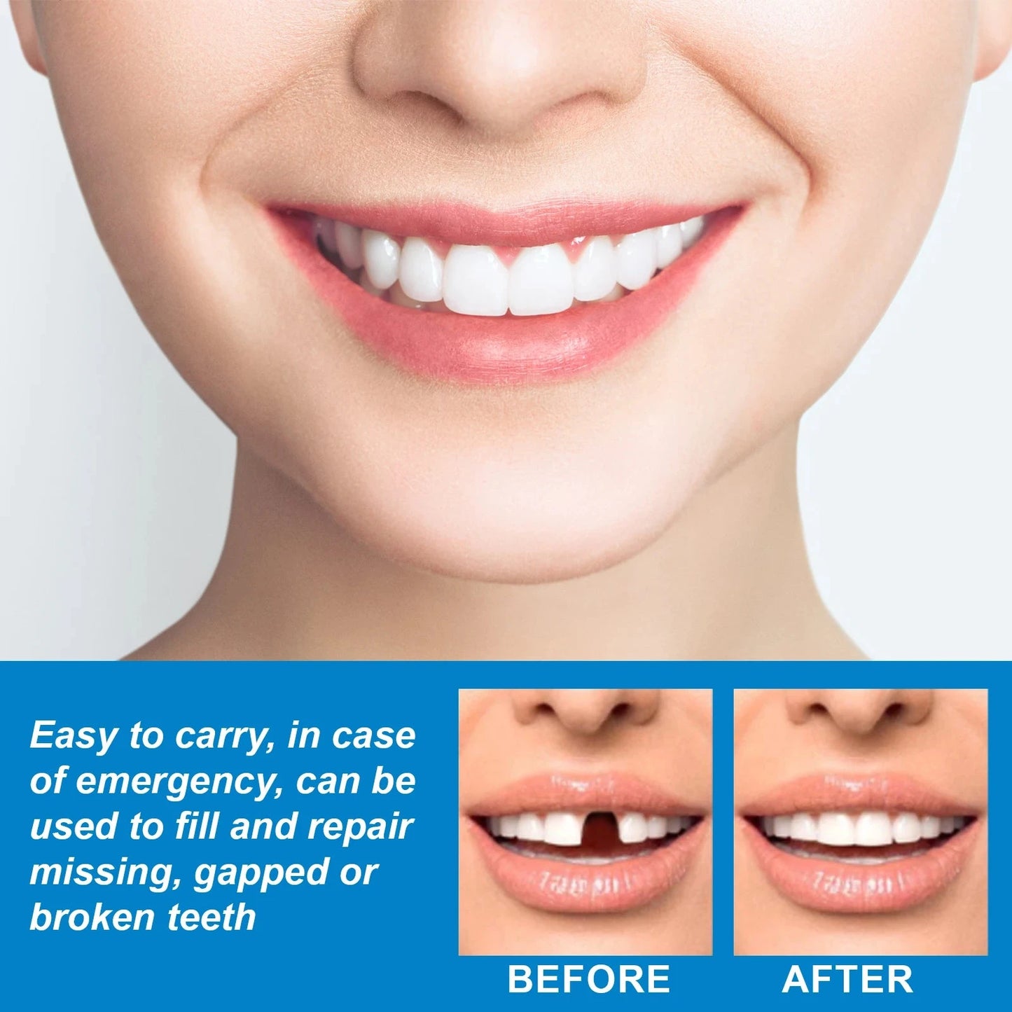 30g Temporary Tooth Repair Moldable Teeth And Gaps False GlowCart