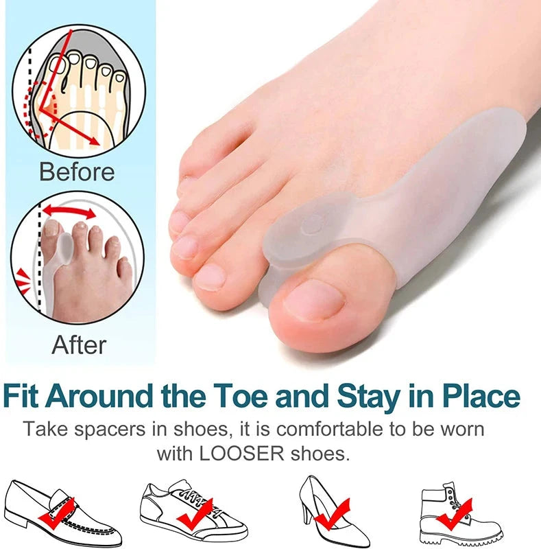 Get Relief from Bunions with 2pcs Soft Big Toe Corrector - GlowCart
