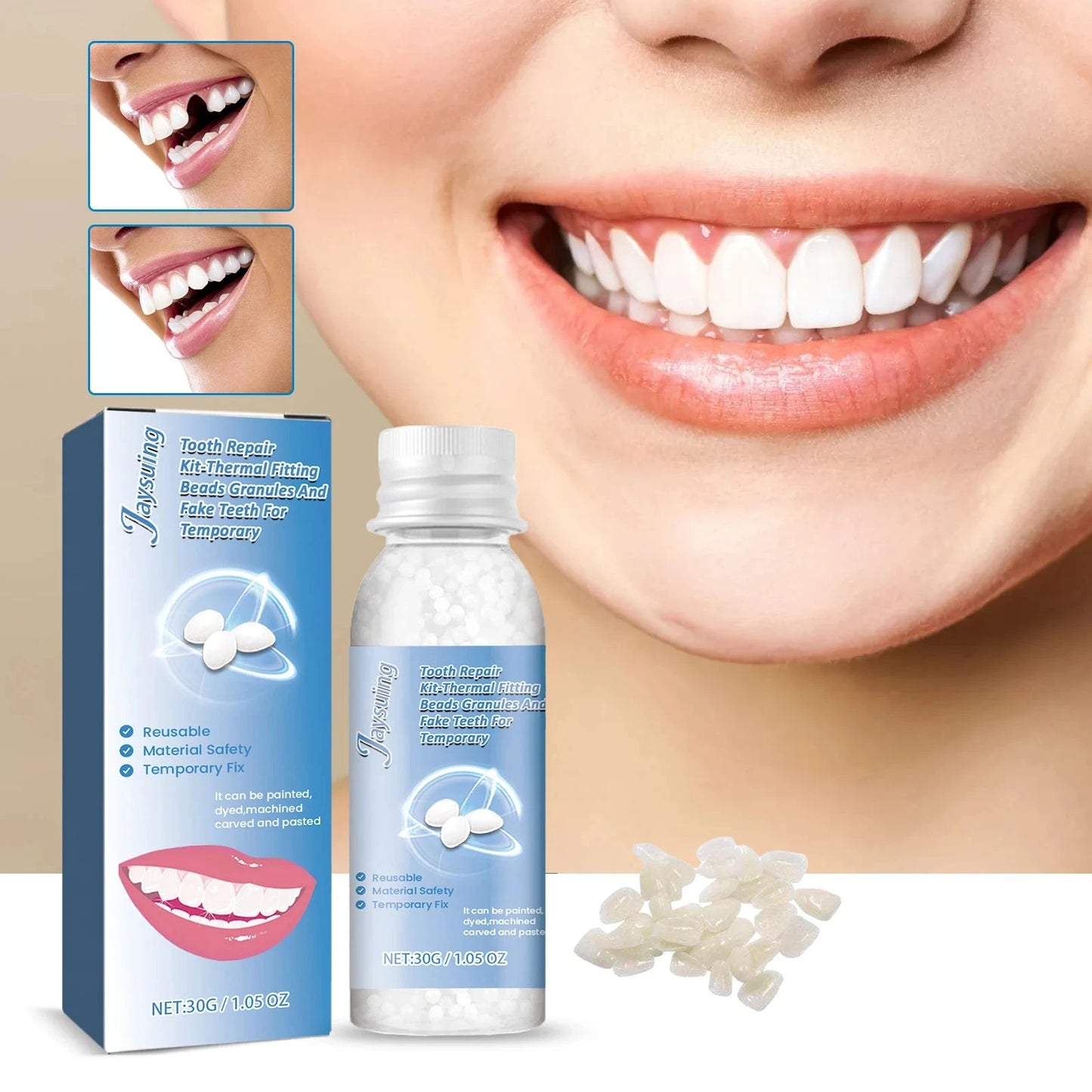 30g Temporary Tooth Repair Moldable Teeth And Gaps False GlowCart