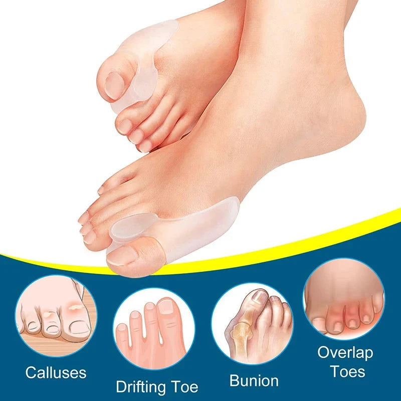 Get Relief from Bunions with 2pcs Soft Big Toe Corrector - GlowCart